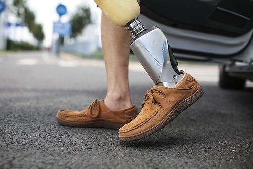 假肢價格力康假肢廠家制造出來產(chǎn)品性能優(yōu)勢(圖1) 假肢價格力康假肢廠家制造出來產(chǎn)品性能優(yōu)勢(圖1)